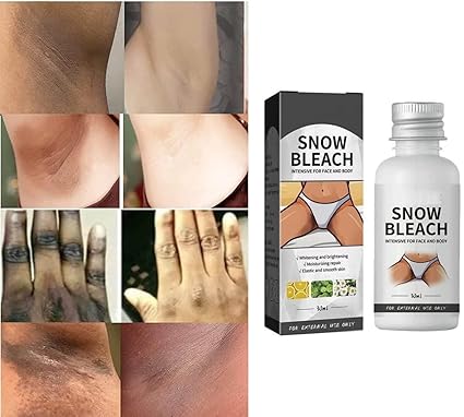 Dark Spot Remover Cream